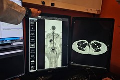 Asl Bat, al “Bonomo” arriva la Risonanza Magnetica Whole Body: svolta nella diagnostica oncologica