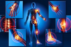 Fibromialgia: Come comportarsi a tavola?