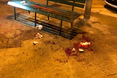 Aggressione nella notte in piazza Natale d'Agostino, un ferito ricoverato in ospedale