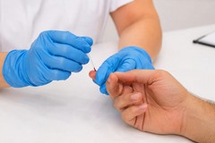 Asl Bat, screening gratuito per l'epatite C: un'opportunità per la diagnosi precoce