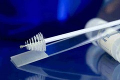 Trani, Pap-test day gratuito: l'iniziativa del Distretto 5 e della LILT