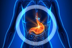 Dal reflusso gastroesofaeo all'esofago di Barrett