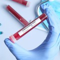 Coronavirus, 83 nuovi casi in Puglia. 25 nella Bat