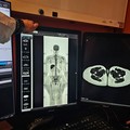 Asl Bat, al “Bonomo” arriva la Risonanza Magnetica Whole Body: svolta nella diagnostica oncologica