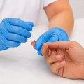 Asl Bat, screening gratuito per l'epatite C: un'opportunità per la diagnosi precoce