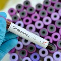 Coronavirus, 63 casi in Puglia. Quattro nella Bat